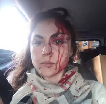 Procuradora é agredida com socos e chutes por colega de trabalho que é liberado após ser ouvido na delegacia