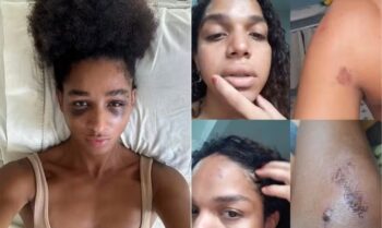 Duas mulheres trans e uma cis foram atacadas de forma física e verbal por cerca de 20 homens em casa de show do Rio de Janeiro