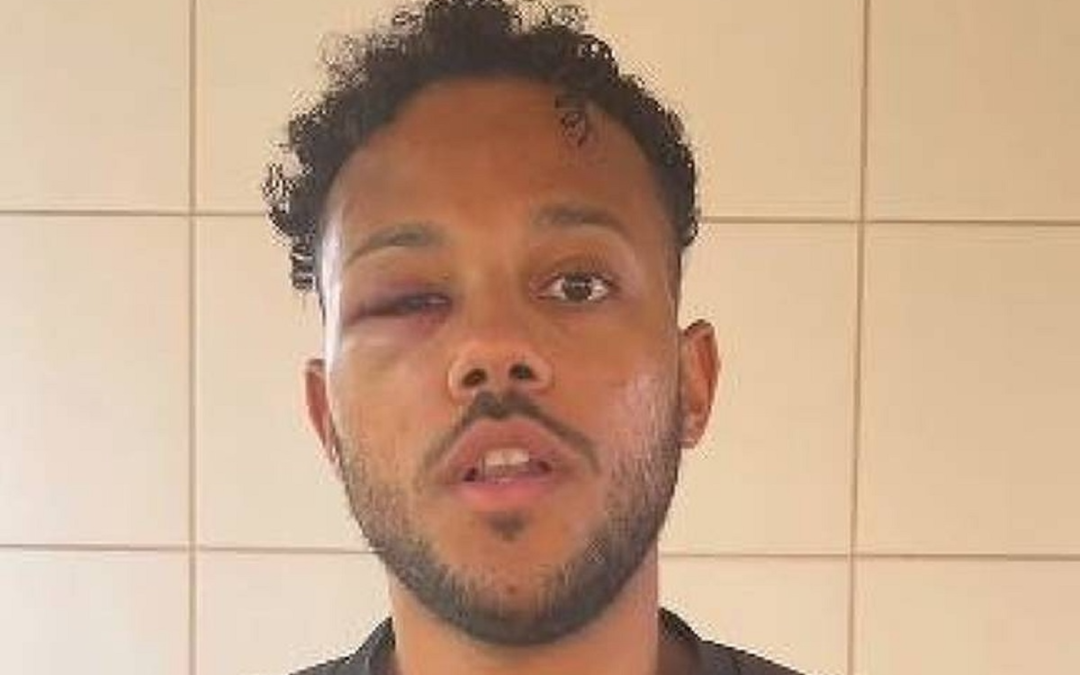 “Isso não aconteceria com uma pessoa branca”, afirma jovem agredido por seguranças no Festival de Verão Salvador