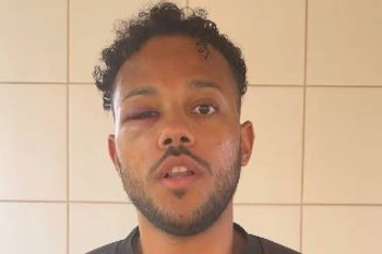 “Isso não aconteceria com uma pessoa branca”, afirma jovem agredido por seguranças no Festival de Verão Salvador