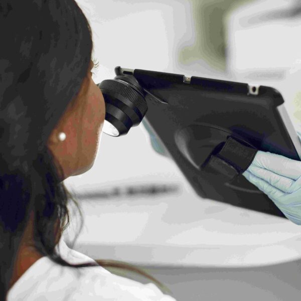 Projeto desenvolve inteligência artificial para diagnóstico de câncer de pele em pessoas negras