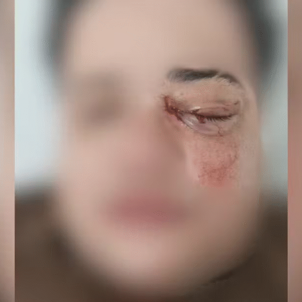 Casal de mulheres é agredido em São José do Rio Preto (SP) e vítima corre risco de perder a visão