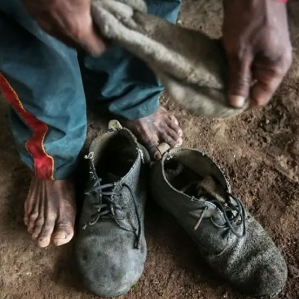 Guia orienta profissionais da saúde a identificar e enfrentar o trabalho análogo à  escravidão